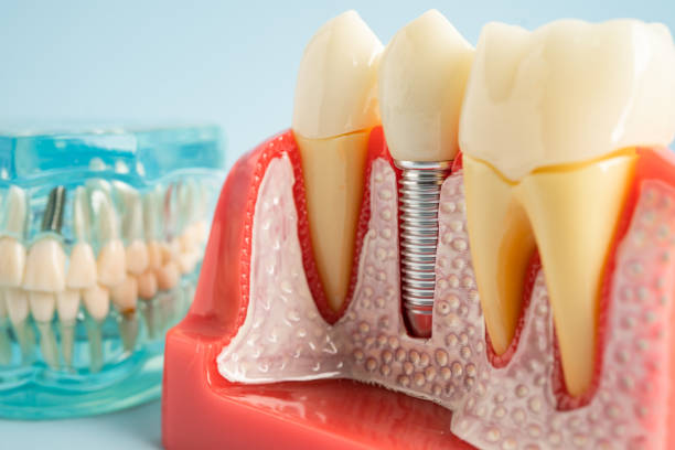 Best Dental Inlays and Onlays  in Kenilworth, NJ